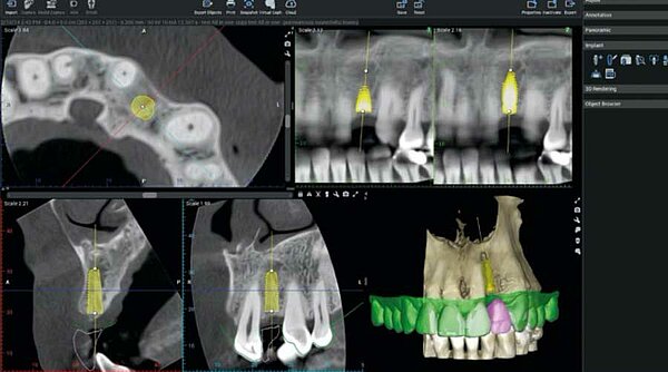 3D-Röntgenaufnahme