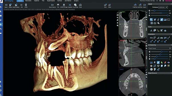 3D-Röntgenaufnahme